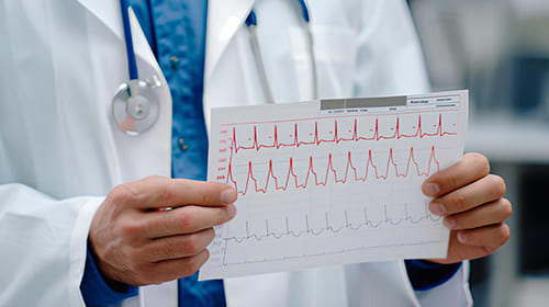 Cardiologue Électrocardiogramme Luxembourg