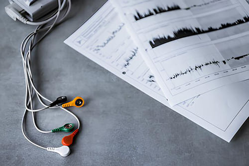 Cardiologue Holter ECG Luxembourg